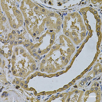 Western blot analysis of extracts of NCI-H460 cells using IL13 Polyclonal Antibody.
