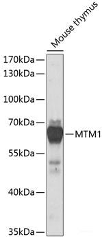 Immunohistochemistry of paraffin-embedded Human colon using DEFB132 Polyclonal Antibody at dilution of 1:100 (40x lens).