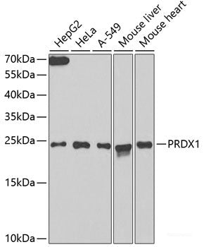 Western blot analysis of extracts of various cell lines using NOP16 Polyclonal Antibody at dilution of 1:3000.