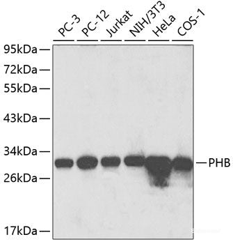 Immunofluorescence analysis of C6 cells using TNFAIP8L2 Polyclonal Antibody at dilution of 1:100. Blue: DAPI for nuclear staining.