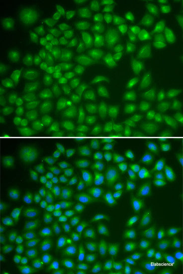 Immunofluorescence analysis of L929 cells using CYP17A1 Polyclonal Antibody at dilution of 1:100. Blue: DAPI for nuclear staining.