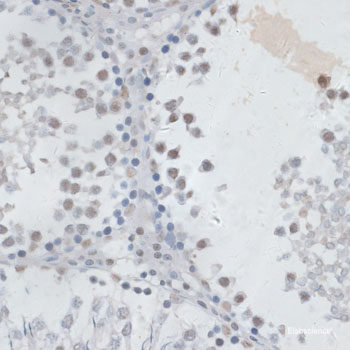 Western blot analysis of extracts of various cell lines using EHD4 Polyclonal Antibody at dilution of 1:3000.