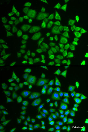 Immunohistochemistry of paraffin-embedded Mouse brain using OGG1 Polyclonal Antibody at dilution of 1:200 (40x lens).