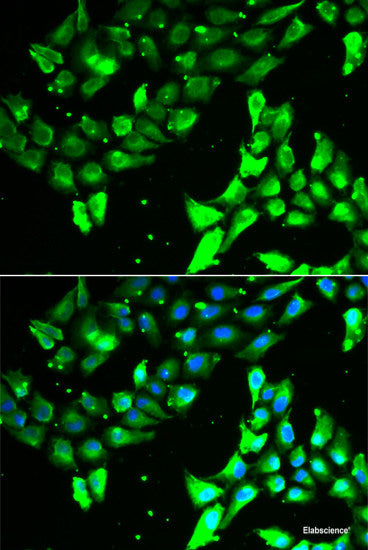 Immunofluorescence analysis of HeLa cells using GABARAP Polyclonal Antibody