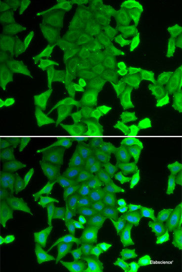 Immunohistochemistry of paraffin-embedded Mouse kidney using AQP5 Polyclonal Antibody at dilution of 1:50 (40x lens).