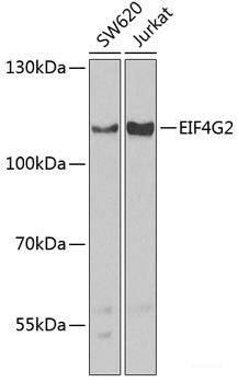 Western blot analysis of extracts of Mouse brain using MGAT5B Polyclonal Antibody at dilution of 1:3000.