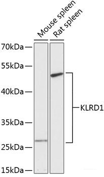 Western blot analysis of extracts of Mouse brain using FUT10 Polyclonal Antibody at dilution of 1:3000.