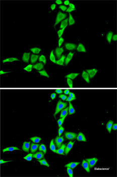 Immunofluorescence analysis of HeLa cells using TIMP1 Polyclonal Antibody at dilution of 1:100. Blue: DAPI for nuclear staining.