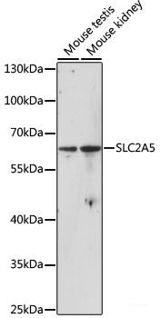 Western blot analysis of extracts of Mouse heart using LIMS1 Polyclonal Antibody at dilution of 1:1000.
