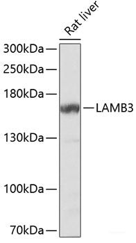 Western blot analysis of extracts of various cell lines using EMD Polyclonal Antibody at dilution of 1:1000.