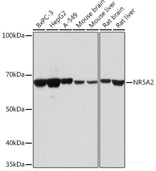 Western blot analysis of extracts of Rat skeletal muscle using AGXT Polyclonal Antibody at dilution of 1:1000.