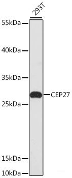 Immunohistochemistry of paraffin-embedded Rat spleen using CEBPE Polyclonal Antibody at dilution of 1:100 (40x lens).