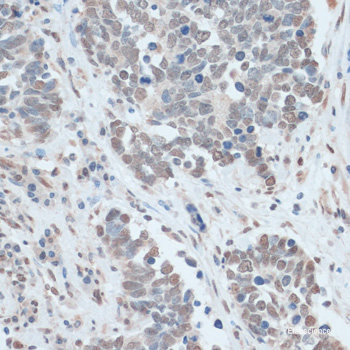 Immunofluorescence analysis of U2OS cells using EWSR1 Polyclonal Antibody
