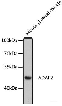 Immunofluorescence analysis of U2OS cells using FCGR3B Polyclonal Antibody at dilution of 1:100. Blue: DAPI for nuclear staining.