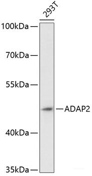 Immunofluorescence analysis of HeLa cells using G6PD Polyclonal Antibody