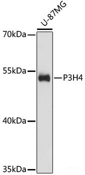 Immunohistochemistry of paraffin-embedded Human kidney using SP110 Polyclonal Antibody at dilution of 1:100 (40x lens).