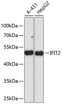 Immunofluorescence analysis of U2OS cells using ITPR1 Polyclonal Antibody at dilution of 1:100. Blue: DAPI for nuclear staining.