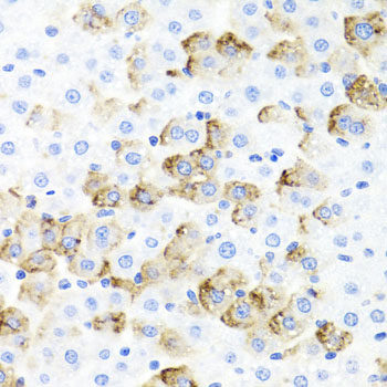 Immunofluorescence analysis of HeLa cells using MAOA Polyclonal Antibody