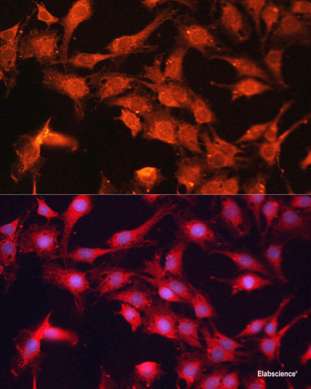 Western blot analysis of extracts of SKOV3 cells using MSH4 Polyclonal Antibody at dilution of 1:1000.