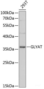 Western blot analysis of extracts of various cell lines using PDHA2 Polyclonal Antibody at dilution of 1:1000.