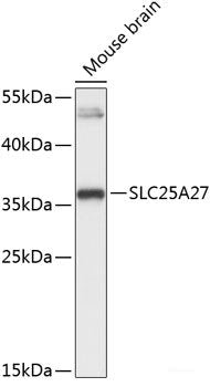 Immunofluorescence analysis of U2OS cells using PLOD2 Polyclonal Antibody
