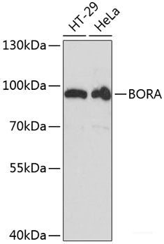 Immunohistochemistry of paraffin-embedded Rat brain using RPL3 Polyclonal Antibody at dilution of 1:100 (40x lens).