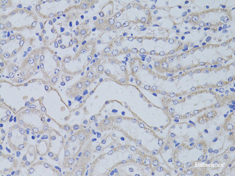 Western blot analysis of extracts of A549 cells using ZNF195 Polyclonal Antibody at dilution of 1:1000.