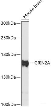 Immunofluorescence analysis of U2OS cells using HYAL3 Polyclonal Antibody