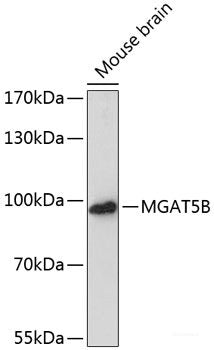 Immunohistochemistry of paraffin-embedded Human kidney using ZNF264 Polyclonal Antibody at dilution of 1:100 (40x lens).