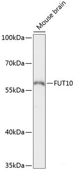 Immunofluorescence analysis of HeLa cells using AKAP5 Polyclonal Antibody at dilution of 1:100. Blue: DAPI for nuclear staining.