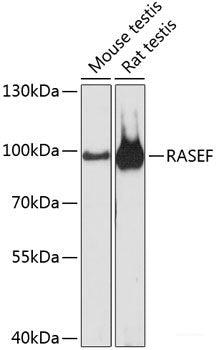 Immunofluorescence analysis of U2OS cells using IGF2BP2 Polyclonal Antibody at dilution of 1:100. Blue: DAPI for nuclear staining.