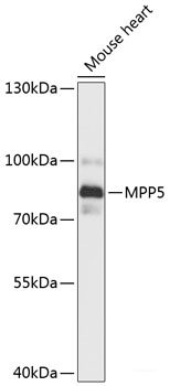 Immunofluorescence analysis of HeLa cells using STIP1 Polyclonal Antibody