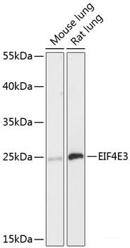 Western blot analysis of extracts of various cell lines using SIRT2 Polyclonal Antibody at dilution of 1:1000.