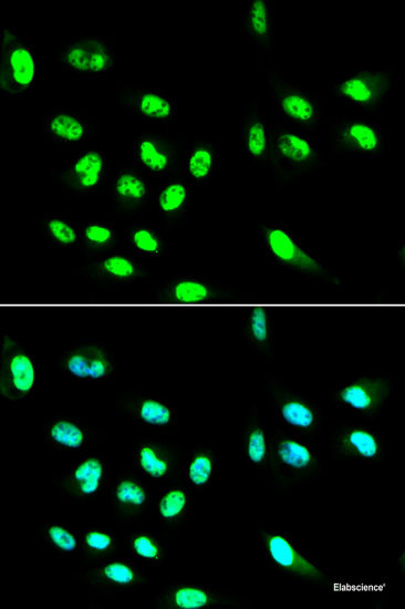 Western blot analysis of extracts of Rat brain using ATG4B Polyclonal Antibody at dilution of 1:1000.