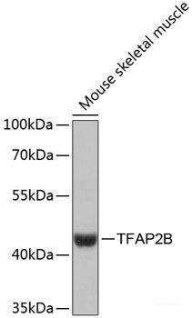 Western blot analysis of extracts of various cell lines using CACNG4 Polyclonal Antibody at dilution of 1:1000.