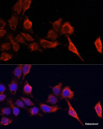 Immunohistochemistry of paraffin-embedded Human prostate using PSAT1 Polyclonal Antibody at dilution of 1:100 (40x lens).