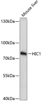 Confocal immunofluorescence analysis of U2OS cells using NOP58 Polyclonal Antibody at dilution of 1:100. Blue: DAPI for nuclear staining.