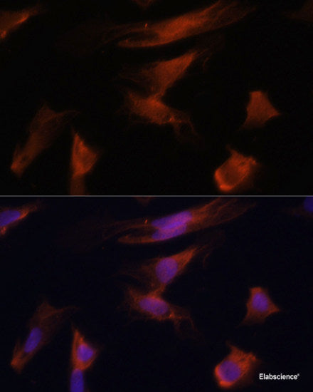 Western blot analysis of extracts of various cell lines using CSNK1G1 Polyclonal Antibody at dilution of 1:1000.