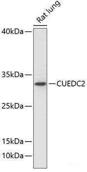 Immunofluorescence analysis of Human breast using RNF31 Polyclonal Antibody at dilution of 1:100 (40x lens). Blue: DAPI for nuclear staining.