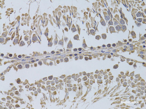 Immunofluorescence analysis of U2OS cells using PHC3 Polyclonal Antibody