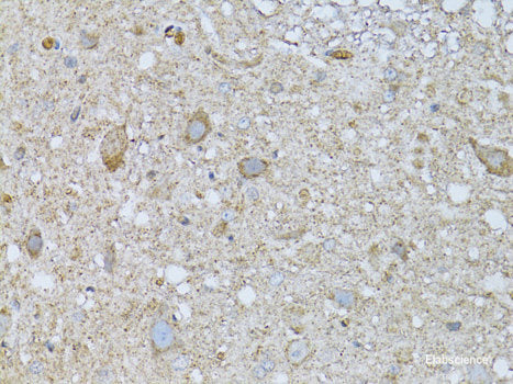 Immunofluorescence analysis of HeLa cells using CANT1 Polyclonal Antibody