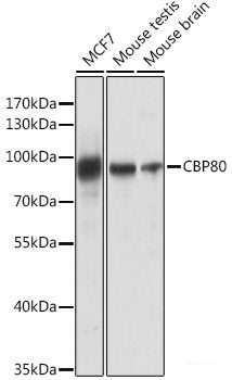Western blot analysis of extracts of various cell lines using MYL2 Polyclonal Antibody at dilution of 1:500.