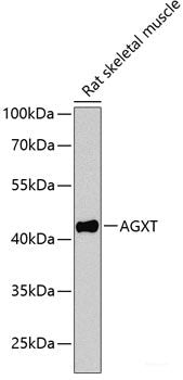 Immunohistochemistry of paraffin-embedded Human liver damage using NRF1 Polyclonal Antibody at dilution of 1:100 (40x lens).