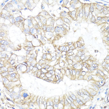 Immunohistochemistry of paraffin-embedded Rat kidney using GNAI2 Polyclonal Antibody at dilution of 1:100 (40x lens).