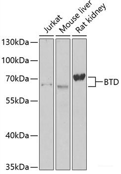 Western blot analysis of extracts of Mouse kidney using PIM1 Polyclonal Antibody at dilution of 1:3000.
