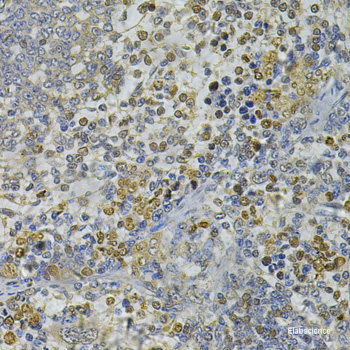 Immunofluorescence analysis of HeLa cells using CYP3A4 Polyclonal Antibody at dilution of 1:100 (40x lens). Blue: DAPI for nuclear staining.