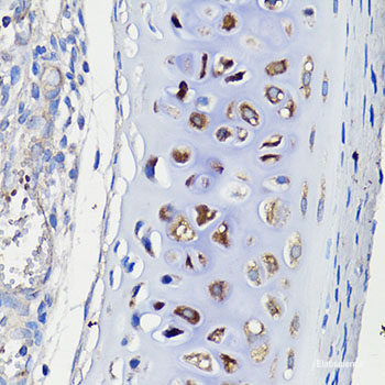 Immunofluorescence analysis of NIH/3T3 cells using UBIAD1 Polyclonal Antibody at dilution of 1:100. Blue: DAPI for nuclear staining.