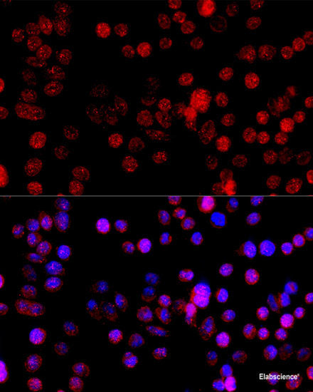 Immunohistochemistry of paraffin-embedded Rat lung using VASP Polyclonal Antibody at dilution of 1:100 (40x lens).