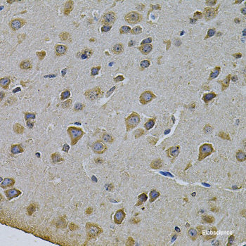 Immunofluorescence analysis of A549 cells using AMY2B Polyclonal Antibody