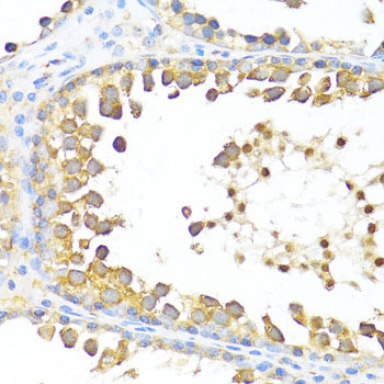 Immunohistochemistry of paraffin-embedded Human appendix using Acetyl-Histone H4-K12 Polyclonal Antibody at dilution of 1:200 (40x lens).